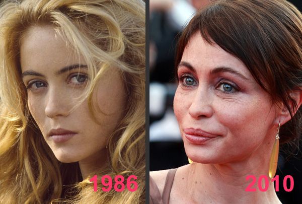 Emmanuelle Béart avant après