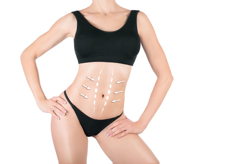 abdominoplastie tunisie prix