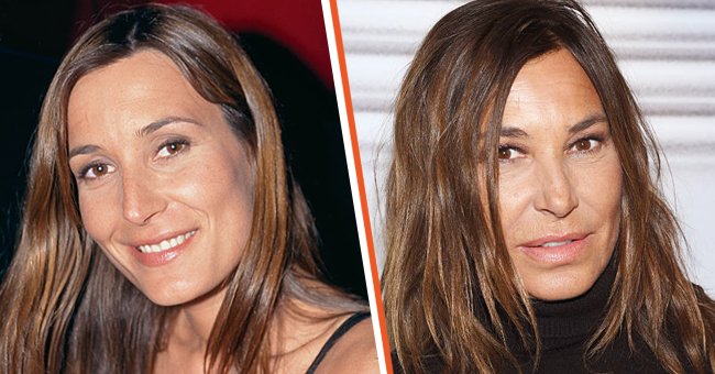 zazie avant apres rhinoplastie