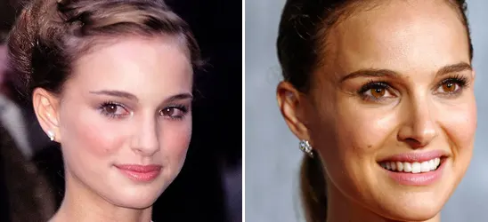 Natalie Portman avant après 