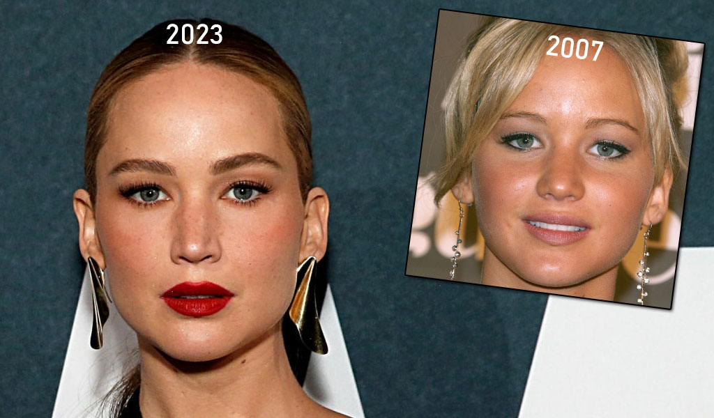 Jennifer Lawrence et la chirurgie esthétique